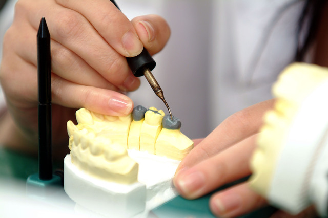 歯科技工士の仕事