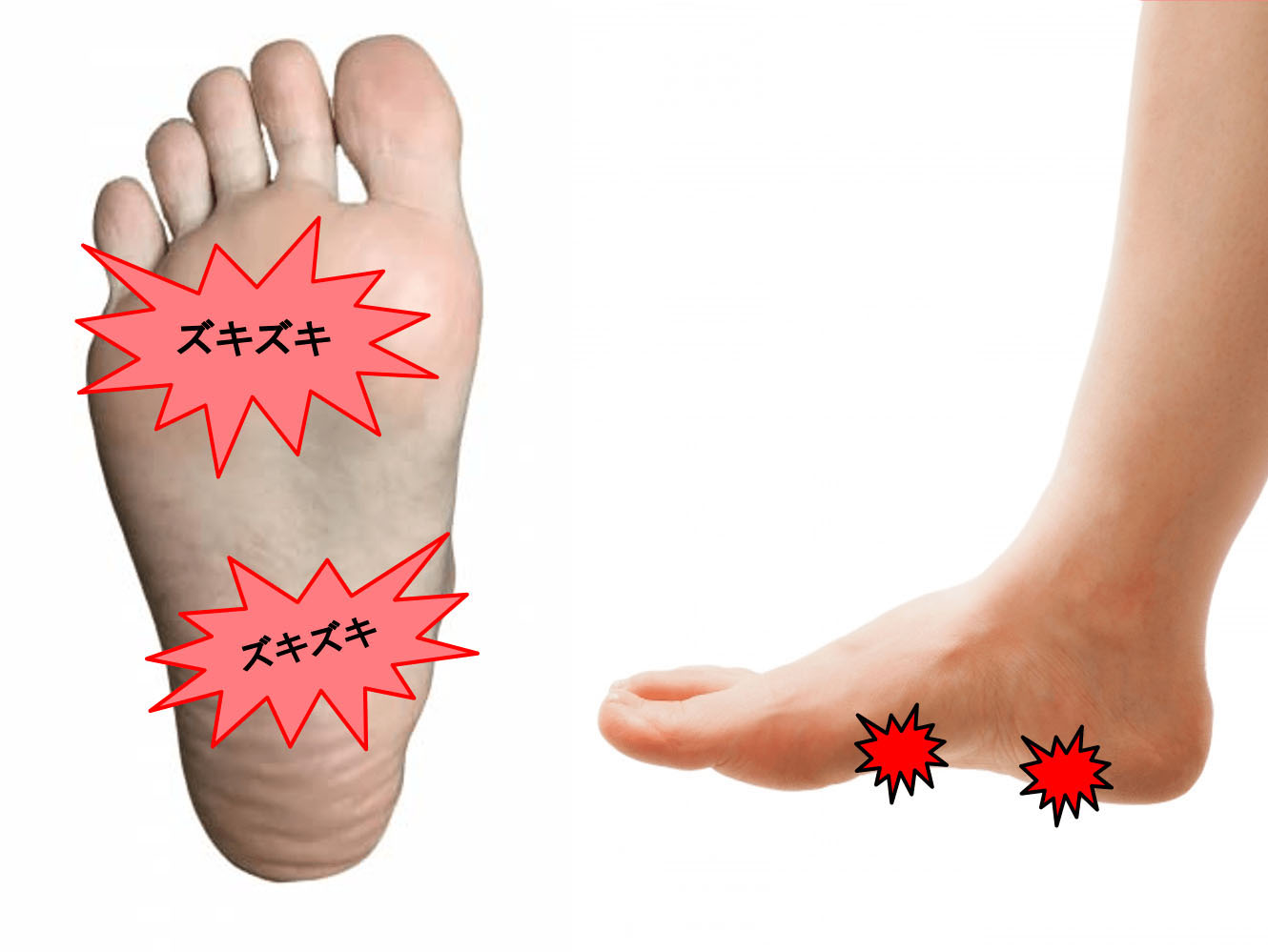 下腿の筋肉は何ですか?